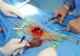 Oddělení cévní a plastické chirurgie Pardubické nemocnice oslavilo 5 let