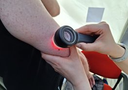 Pozvánka na preventivní akci Dny melanomu