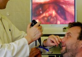 Nové přístroje na ORL klinice pomohou v léčbě nádorů a spánkových problémů