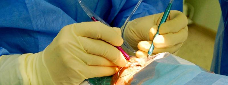 Oční chirurgové Pardubické nemocnice operují šedý zákal s technickou novinkou